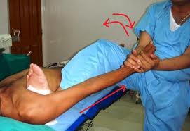 cum să tratezi luxația articulației genunchiului în spitz