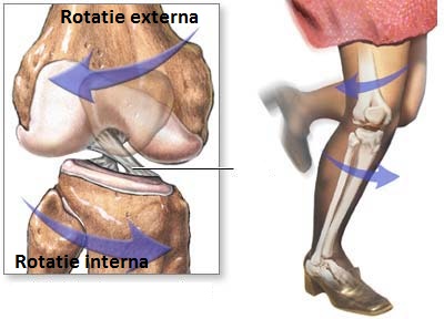 Ruptură de ligament a genunchiului – tipuri de tratament