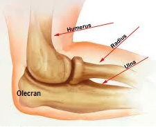 inflamație cronică a genunchiului ce sunt artrita genunchiului