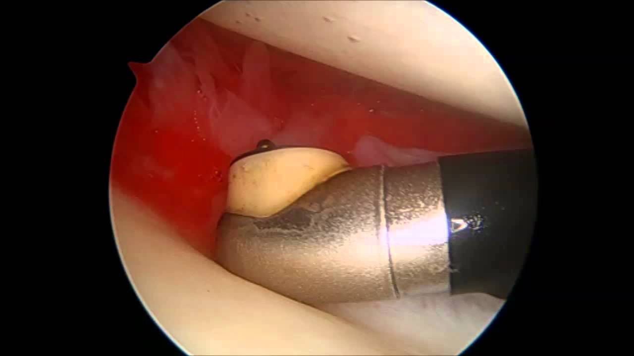 f6