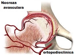 unguent sau gel pentru artroza genunchiului cum să tratezi osteocondroza