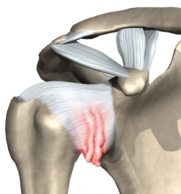 durere în articulațiile picioarelor și ale coloanei vertebrale dureri de spate severe persistente