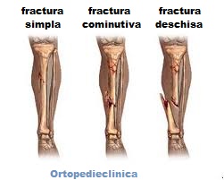 dureri la nivelul soldului și articulației pelvine dureri articulare de îngrijire a piciorului