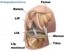 tratamentul fracturilor intraarticulare ale genunchiului