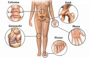 osteoartrita articulațiilor coloanei vertebrale