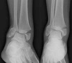 boli ale tesutului conjunctiv umflături la genunchi și dureri