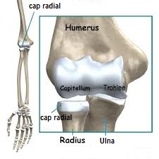 tratamentul fracturii radiale la cot
