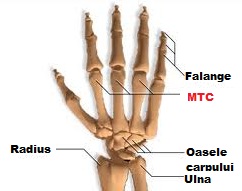 tratamentul fracturilor la încheietura mâinii