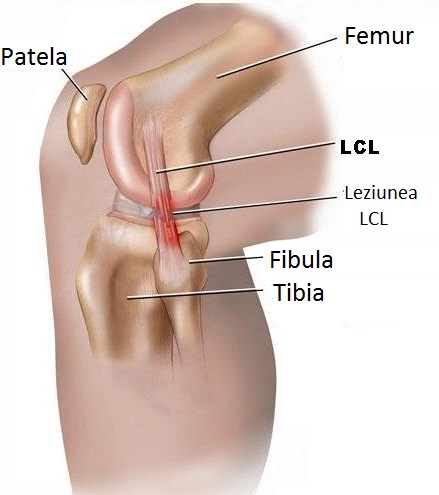 durere la extensia genunchiului după