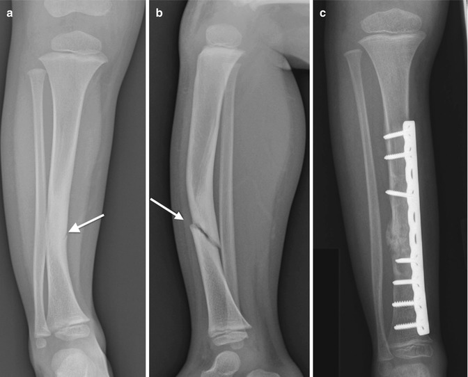durere în articulația genunchiului inflamația tratamentului gleznei piciorului
