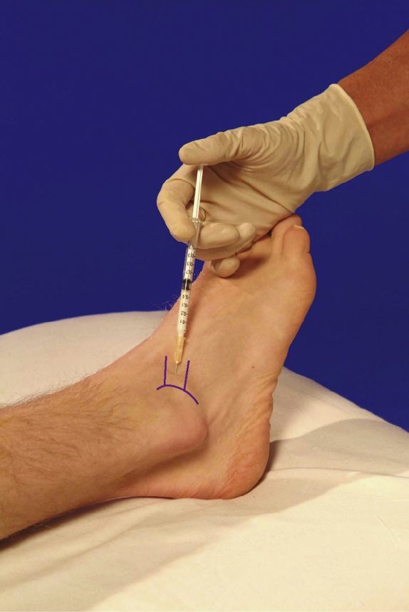 boala cum să tratezi articulațiile dureri articulare deformarea piciorului