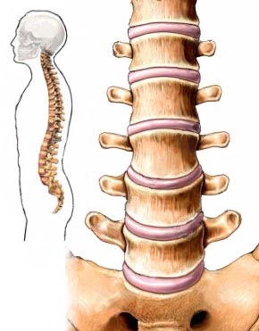 osteocondroza polisegmentală a coloanei vertebrale)