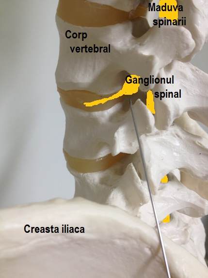 tratamentul electrostal al coloanei vertebrale și articulațiilor