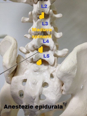 ingustarea spatiului intervertebral l5 s1 care va ajuta cu durerea în articulația umărului