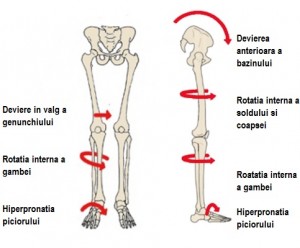 skeletoneffects