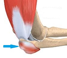 tratamentul artritei calcanee sau artrozei din cauza umflarea articulației picioarelor