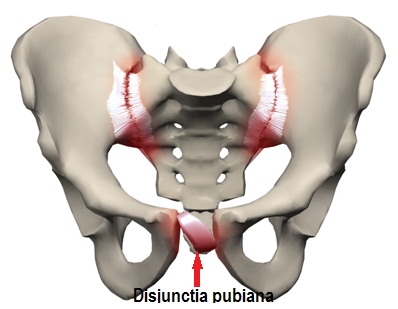 dureri articulare cotului în interior dureri severe la nivelul oaselor și articulațiilor