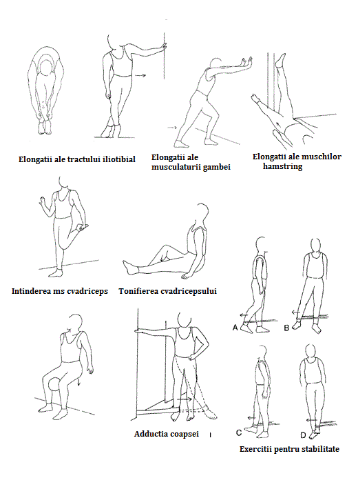 exercitii fizice pentru gonartroza