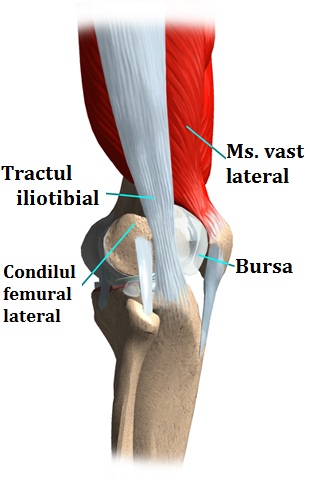 Sindromul tractului ilio-tibial