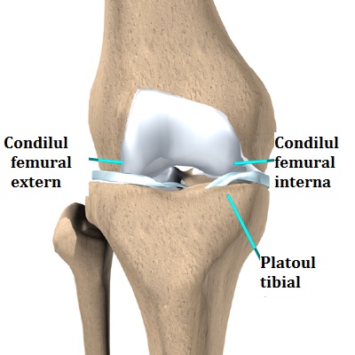 articulația artificială a genunchiului)