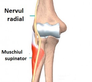 deteriorarea nervului radial în articulația cotului