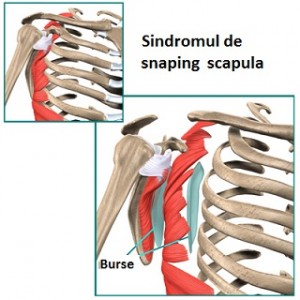 durere între omoplatul stâng și coloana vertebrală osteoartrita articulațiilor extremităților