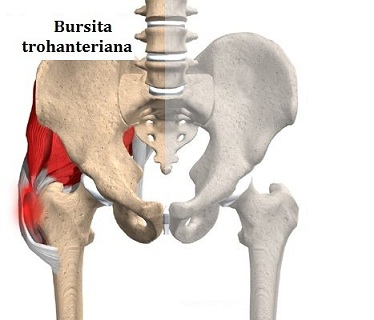 medicamente pentru bursita articulației șoldului durere la nivelul articulațiilor piciorului stâng
