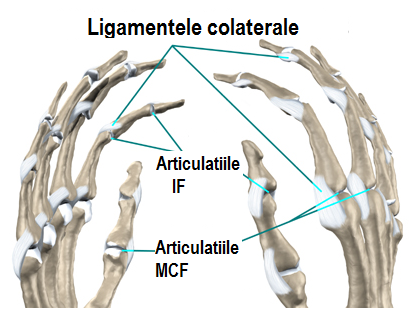 Artroza articulațiilor interfalangiene distale ale mâinilor