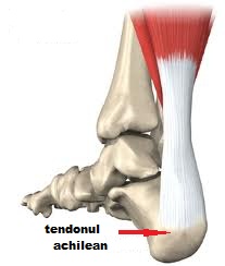 tendonul lui ahile