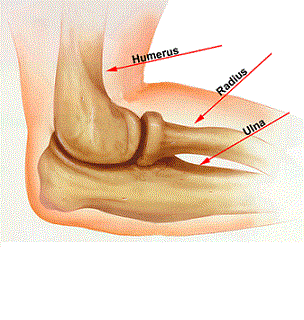Artroza stadiului articulației cotului cotului 1 Artroza articulației 1 cot - Manșetă