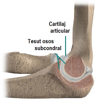 artroza cubică a articulației cotului doare articulația cotului dă umărului