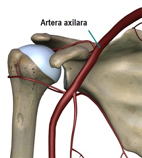 artroza articulației umărului cum să se dezvolte