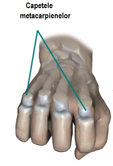 durere în articulațiile degetelor de la mâini și de la picioare restaurarea articulației genunchiului