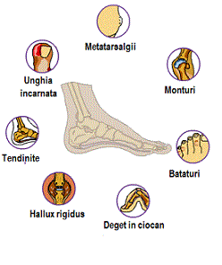 dureri articulare din vârful piciorului