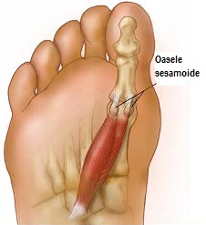 articulația degetului mare de la piciorul stâng