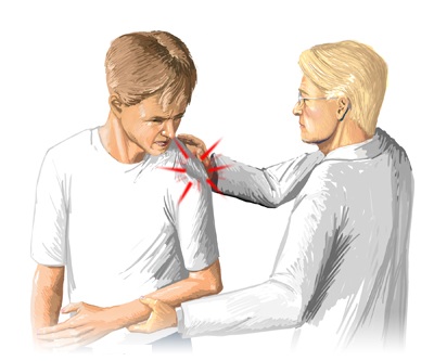 artroza simptomelor și tratamentului articulației umărului drept pentru dureri articulare după un accident vascular cerebral