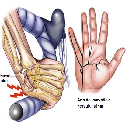 articulația încheietura mâinii doare după lovire