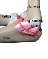 leziuni ale ligamentului cotului artroza tratamentului articulației genunchiului cu pastile