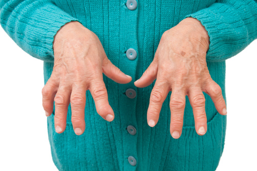 boli inflamatorii la încheietura mâinii