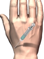 Articulația degetului mic doare în palma mâinii