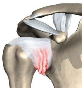 shoulder_adhesive_capsulitis_intro01