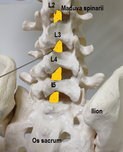 epidurala 5