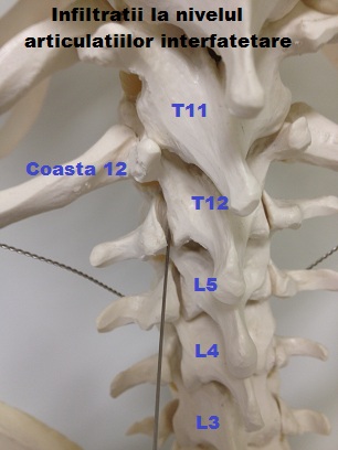 interfatetara 1