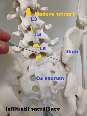 sacroiliaca 1