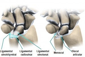 wrist_tfcc_anatomy05