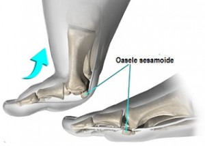 foot_sesamoiditis_anat03