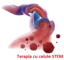 STEM