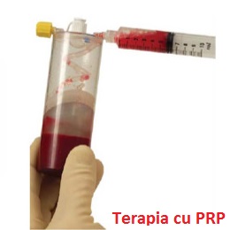 prp